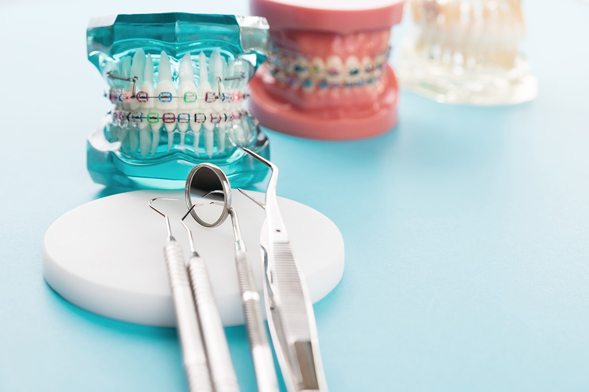 Orthodontic Rubber Bands in Spring, League City, & Cypress, TX